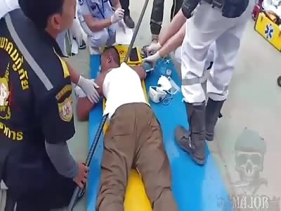 shocking accident with worker