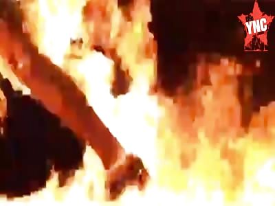 Accidental/Self Immolation - Burnt Alive