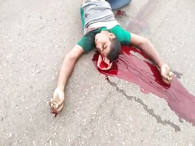 Shocking accident in street
