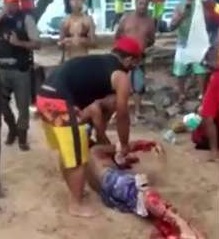 Tourist Loses Leg... Ripped Apart by a Shark
