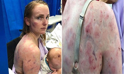 Mother Attacked by Weather Machete (After Clicking Scroll Down)