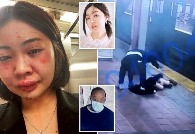 A Thai Model Was Brutally Beat & Robbed On The NYC Subway