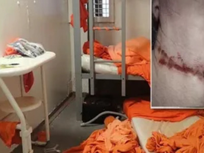 New Photos From Inside Epstein's Cell and His Wounds From Hanging.