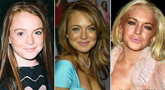 The Sad Aging of The Crack Whore Known as LiLo