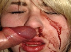 Dude Gives Girl Bloody Nose Smashing His Cock on her Face