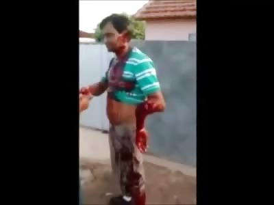 STAY COOL: Man Hacked up by Machete Blows with his Harm Hanging Off Calmly Waits for Help