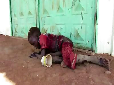Very Sad Video of a Boy that Was Struck by a Missile 