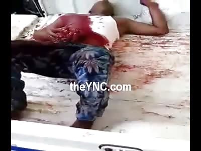 Gruesome Video Shows Man in Agony Holding his Guts in after Being Stabbed