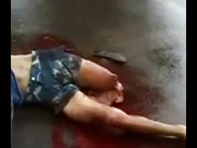 OUCH! Man in Agony with his  Leg Tore Off in Horrific Accident