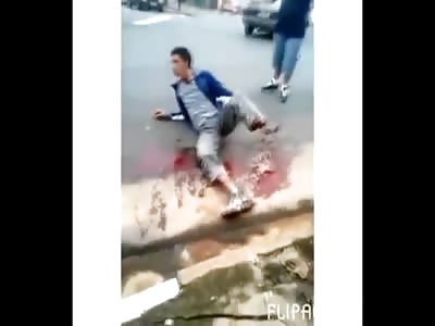 Kid in Total Agony with Foot Ripped off (Look at Perfectly Severed Foot Dangling from Car)
