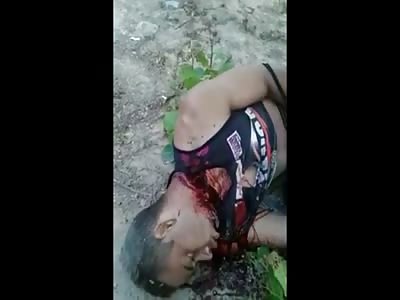 Hard to Watch Video of a Man Slowly Dying...Video is Graphic 