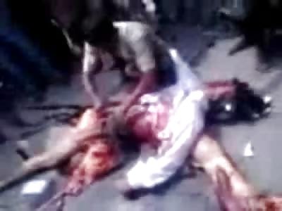 Be Safe on the Street, Man lies on his Own Leg in Gory Aftermath 