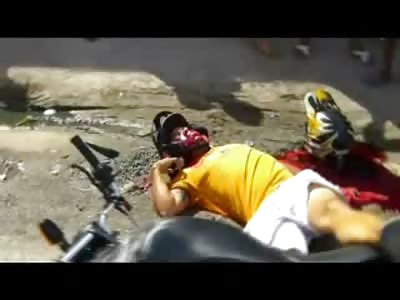 Cameraman Captures Man Foaming at the Mouth and Blood Gurgling Following Fatal Motorcycle Accident