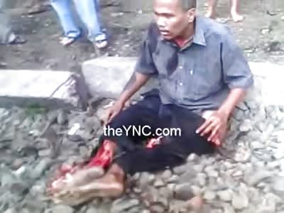 This Guy is in Total Shock after Having his Legs Ripped Open