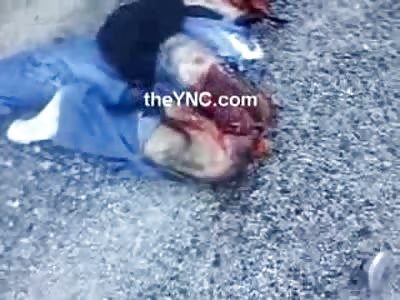Gruesome: Dead Man Skinned to the Guts and his Arm and Shoulder