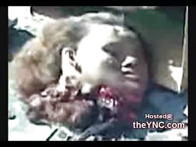 Video showing the head of one the Mentally Retarded Female Suicide Bombers that killed 99 people on 2/2/08