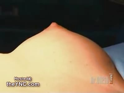 Uncensored Boob Job from DR 90210
