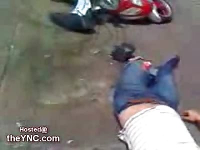 Horrific Crash leaves a Biker with his Leg attached to his Bike