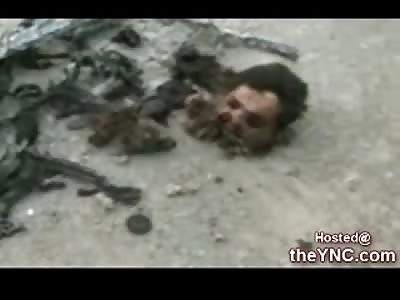 Suicide Bomber in Afghanistan leaves us only Half of His Face