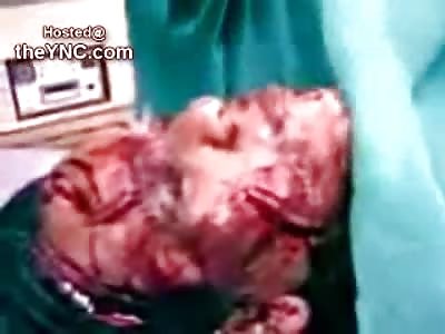 Female Slashed from Head to Toe Speaks to Camera (Full Video, Full Audio)