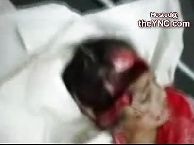 Young Female with Head Blown Open is Examined by Cameraman (High Warning...Graphic Video)