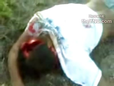 Boys Brain Ejected from Skull, Cameraman goes Inside of Skull