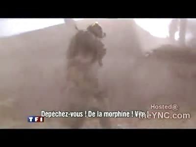 American Solider has Both Legs Blown Right in Front of French News Crew