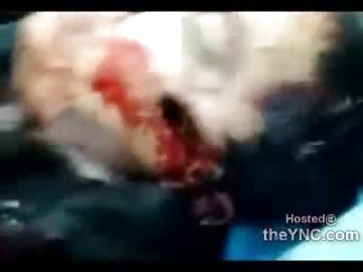 Man in Libya has Shotgun Blast through his Face