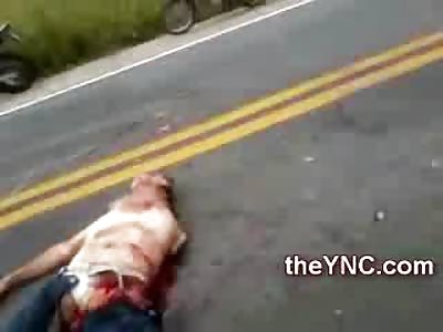 Middle Aged Man with Hairy Chest has Limbs Ripped Off all over the Street
