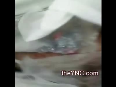 Sneaky Man gets into the Hospital Morgue to Record Mangled Accident Victim
