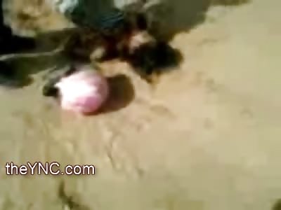 Squirming Female next to her Pink Helmet has Dangling Leg and her Lover Dead down the Road