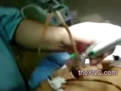 Giant Worm pulled out of Sedated Woman