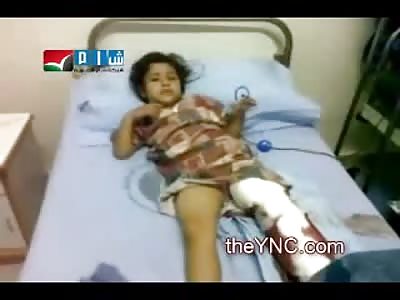 Very Sad: Little Girl has her Leg Blown Off and Amputated by Doctors
