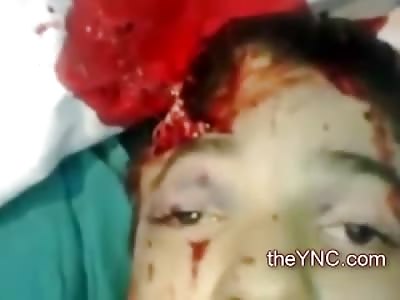 Young Boy Dying from Fatal and Graphic Head Shot takes Final Breath on Camera