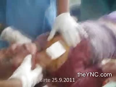 Little Girl with Open Chest Wound and Crushed Skull is trying to Stay Alive
