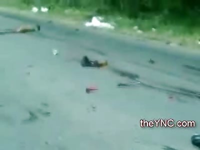 Gruesome Accident rips off Both Legs of Man in the Street