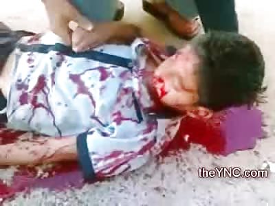 Boy Leaking and Dripping Blood from Fatal Headshot in Syria