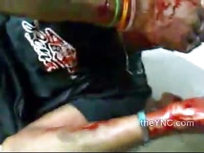 Mans Face Sliced open During Brutal Machete Fight