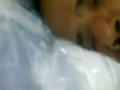 Neglected Man on Hospital Floor Vomiting Maggots