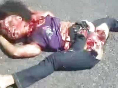 Woman Split Open at the Crotch and Face Mutilated from Accident
