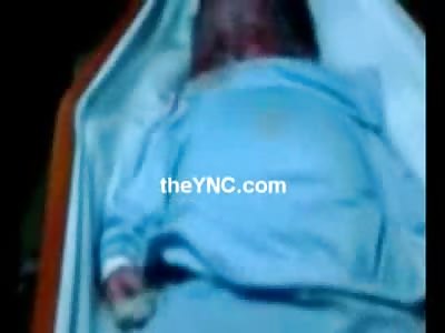 Blue Baby....Bizarre Video of Baby beaten so Badly it turned Blue Everywhere 