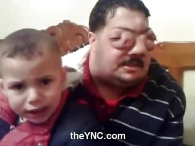 Man with Bizarre Disease speaks to Camera with his Son on his Lap