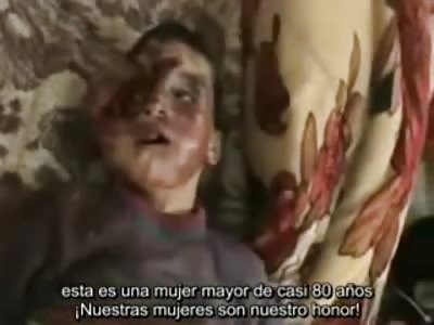 We've All seen Syrian Deaths but this one is Just Terrible...Assad Army Targets School
