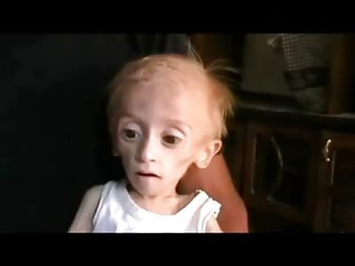 Dying Boy in Syria can No Longer get to his Medicine and Will Die Very Soon...