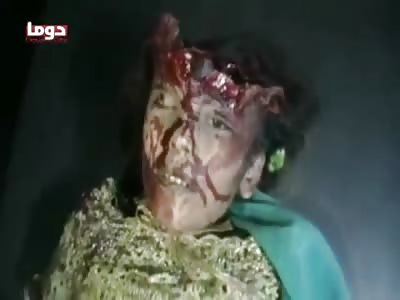 HORRIBLE: Little Girls Head Completely Ripped off from Bombing Attack