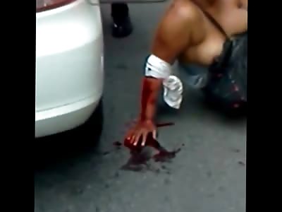 Woman Bleeds out with her Breasts Exposed