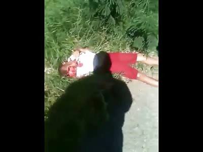 Young Boy in Red Lost his Face after being Thrown from Motorcycle