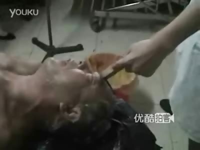 Wooden Stick is Shoved in Mans Head....Doctors use Power Saw to Remove