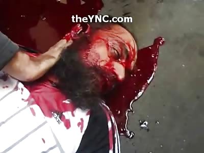 POOL: Man's Neck and Mouth Won't Stop Pouring Blood......Watch Him Die on Camera
