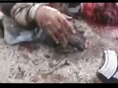 FSA Terrorist Blown in Half but Still Alive,  .... Just Wants Some Water (Dies Moments Later)